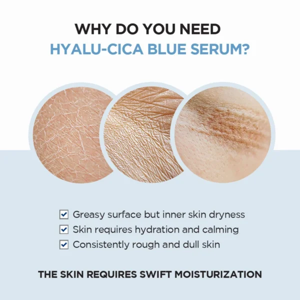 Centella Hyalu Cica Blue Serum 50ml | Korea | Hydrating and Soothing for Sensitive Skin - Image 2